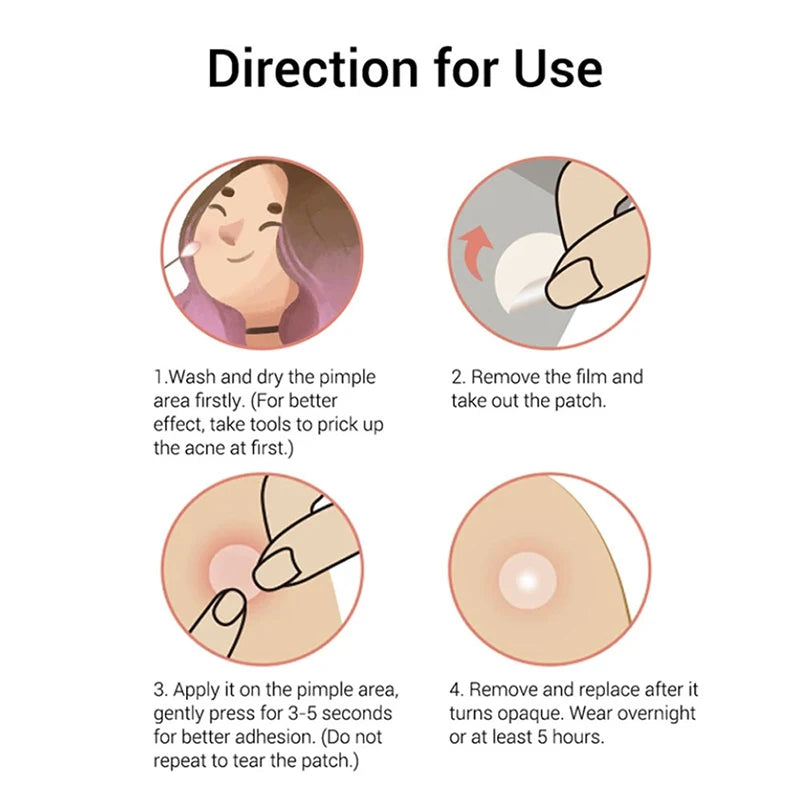 100pcs Sanrio Hello Kitty Acne Stickers - Image 4