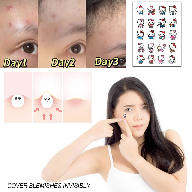 100pcs Sanrio Hello Kitty Acne Stickers - Image 3